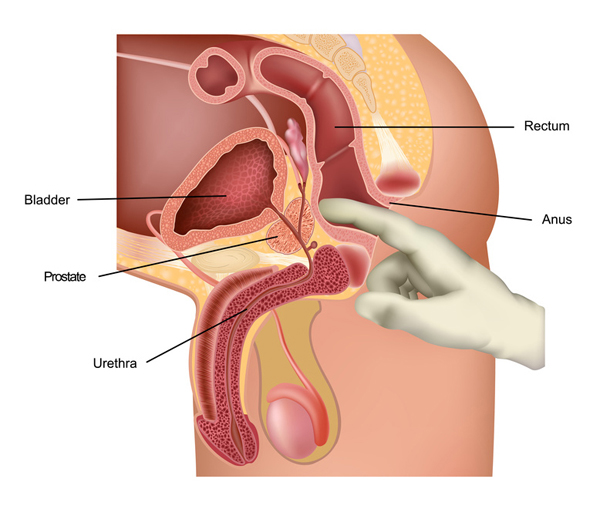 Prostate Diagram